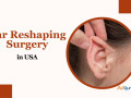 ear-reshaping-surgery-cost-in-usa-small-0