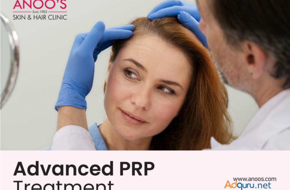 advanced-prp-treatment-for-hair-regrowth-at-anoos-big-0