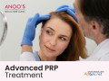 advanced-prp-treatment-for-hair-regrowth-at-anoos-small-0