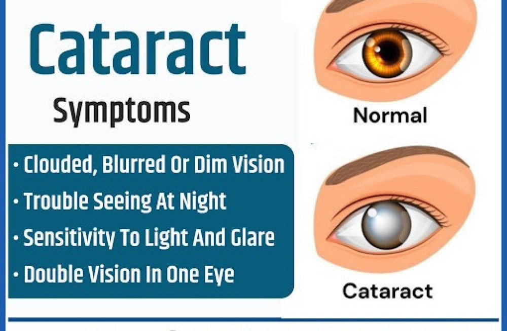 are-you-searching-best-cataract-surgery-treatment-in-raipur-retivision-superspeciality-eye-centre-big-0