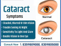 are-you-searching-best-cataract-surgery-treatment-in-raipur-retivision-superspeciality-eye-centre-small-0