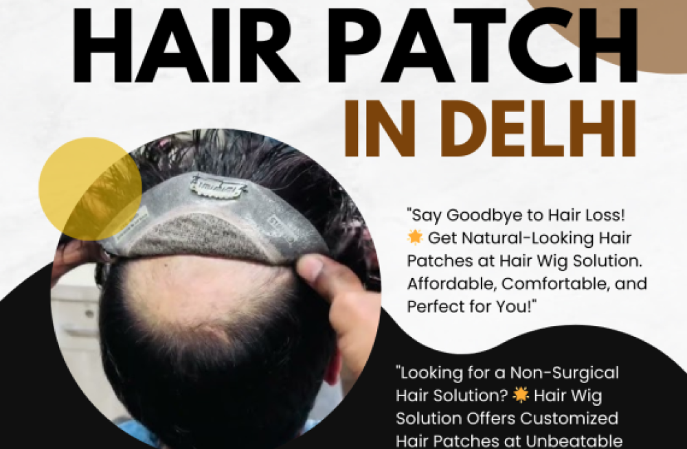 affordable-hair-patch-in-delhi-big-0