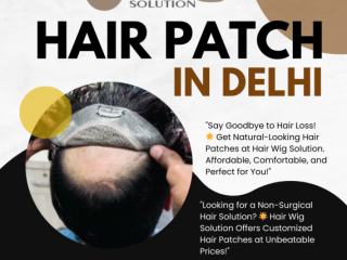 Affordable Hair Patch in Delhi