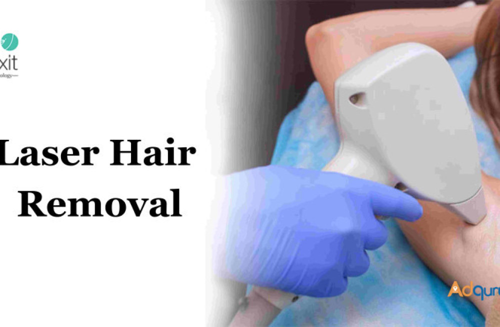 laser-hair-removal-in-bangalore-big-0