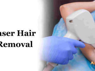 Laser Hair Removal In Bangalore