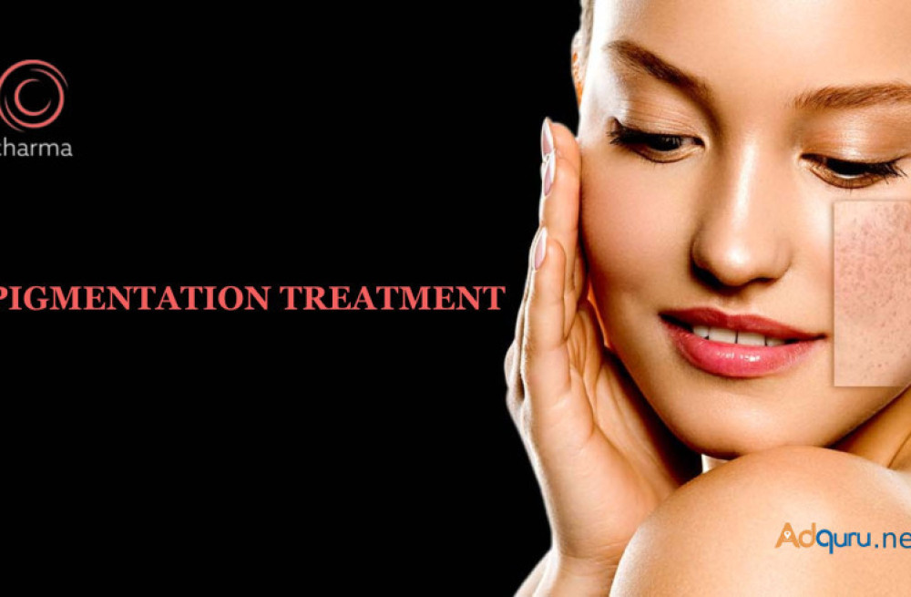 pigmentation-treatment-in-bangalore-big-0