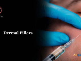 Dermal Fillers in Bangalore