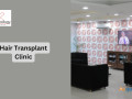 best-hair-transplant-clinic-in-gurgaon-small-0