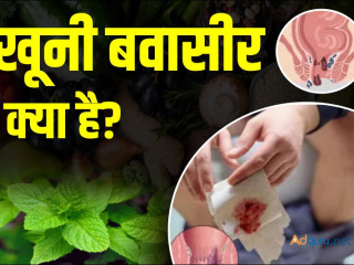 बवासीर की गारंटी की दवा – स्थायी आराम का प्राकृतिक समाधान