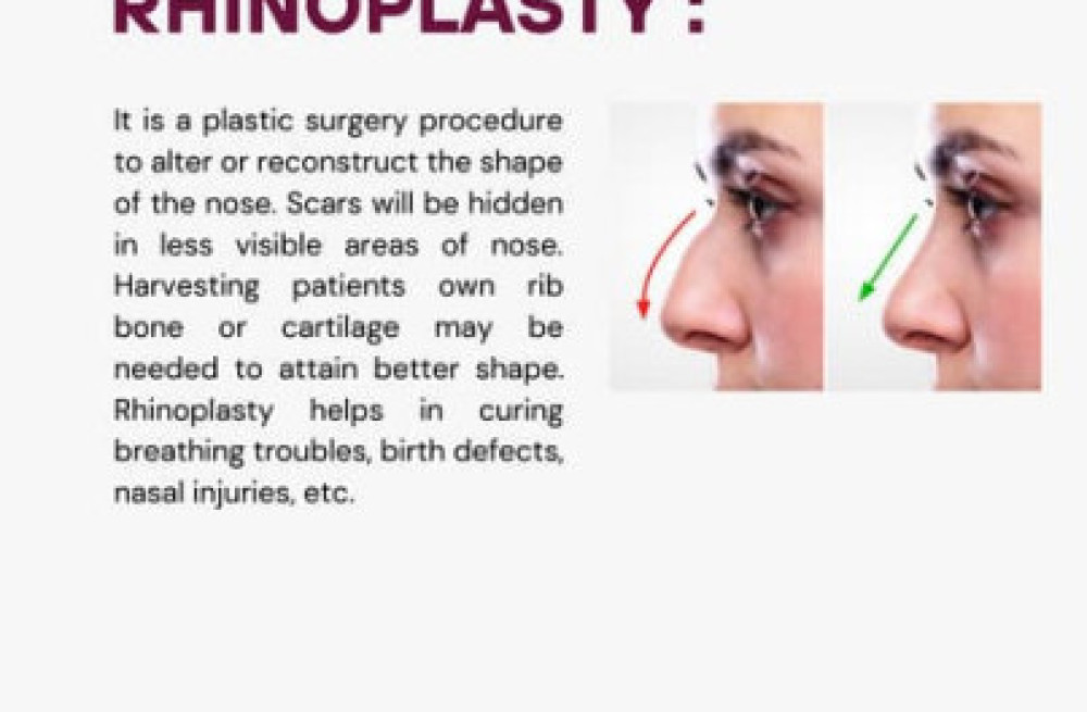 cosmetic-surgeon-doctor-in-coimbatore-sirpi-centre-big-3