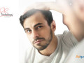 hair-transplant-in-gurgaon-small-0