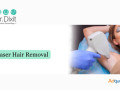 laser-hair-removal-in-bangalore-at-dr-dixit-cosmetic-dermatology-small-0