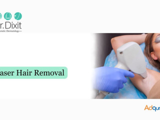 Laser Hair Removal In Bangalore at Dr. Dixit Cosmetic Dermatology