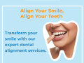 transform-your-smile-at-archak-dental-best-dental-clinic-in-bangalore-small-0