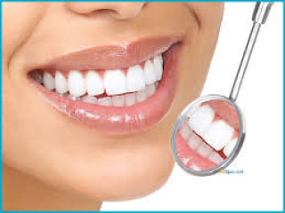 Smile Makeover In Pune