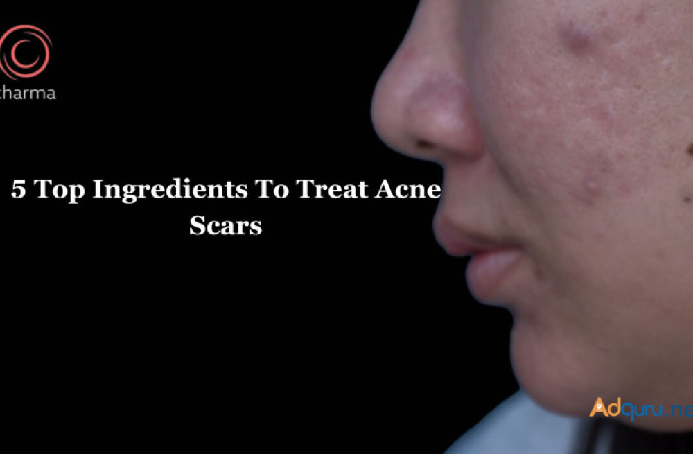 acne-treatment-in-bangalore-at-charma-clinic-big-0