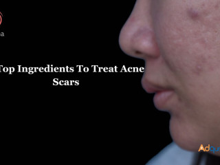 Acne Treatment In Bangalore at Charma Clinic