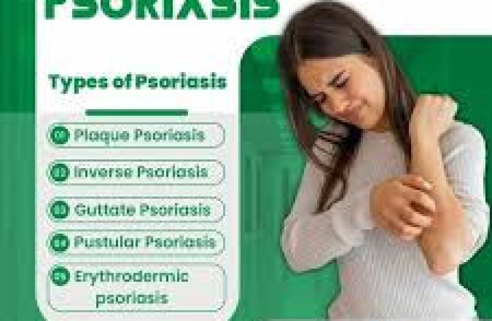 ayurvedic-remedy-for-psoriasis-in-mumbai-big-0