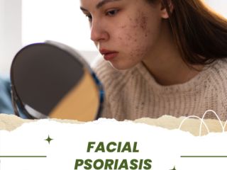 Finding Lasting Relief: Effective Solutions for Skin and Scalp Psoriasis Treatment