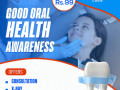 best-dental-clinic-in-coimbatore-small-0