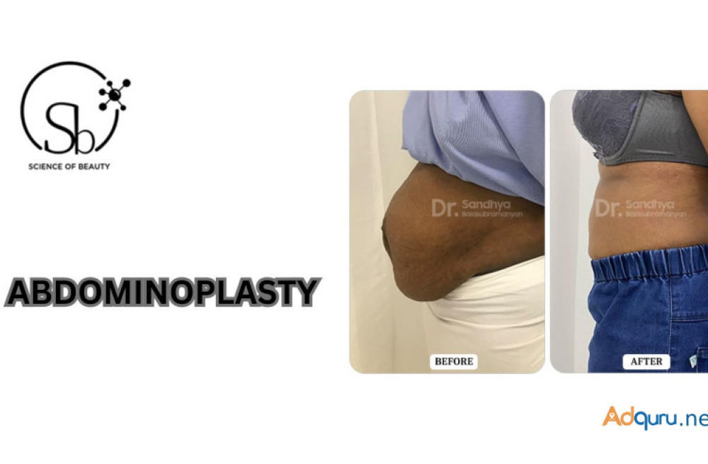 best-abdominoplasty-surgery-in-bangalore-dr-sandhya-balasubramanyan-big-0