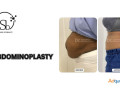 best-abdominoplasty-surgery-in-bangalore-dr-sandhya-balasubramanyan-small-0