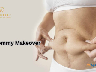 Best Mommy Makeover In Hyderabad