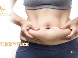 Tummy Tuck In Hyderabad