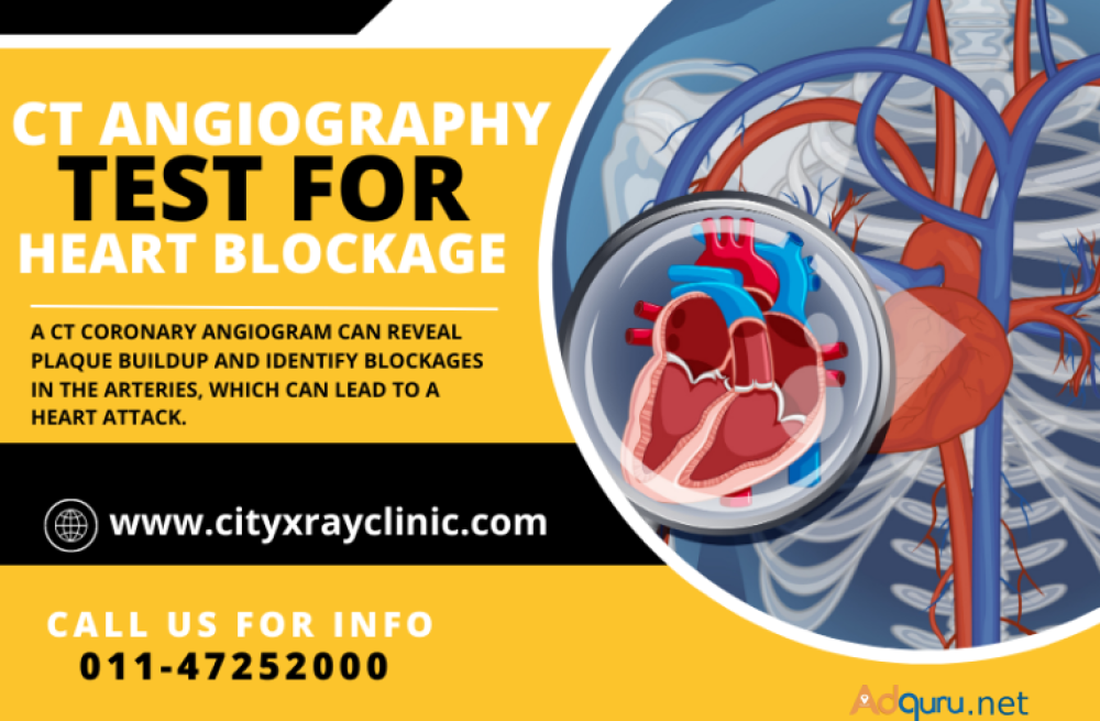 ct-coronary-angiography-scan-near-me-in-delhi-at-affordable-price-big-0