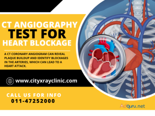 CT Coronary Angiography Scan Near Me In Delhi At Affordable Price