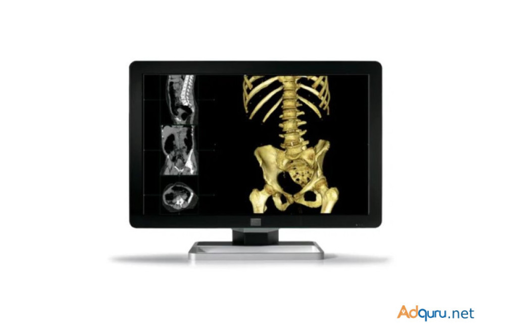 medical-diagnostic-display-enhancing-healthcare-imaging-solutions-big-0