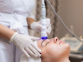 microneedling-radiofrequency-services-small-0