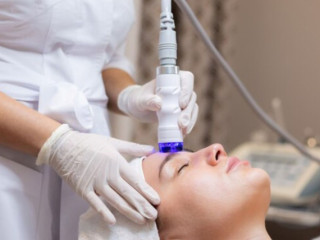 Microneedling Radiofrequency Services