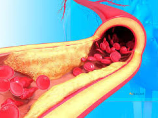 Rosuvastatin medication