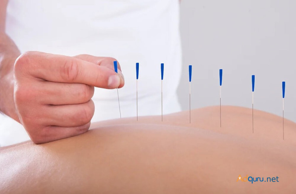 acupuncture-clinic-nyc-big-0