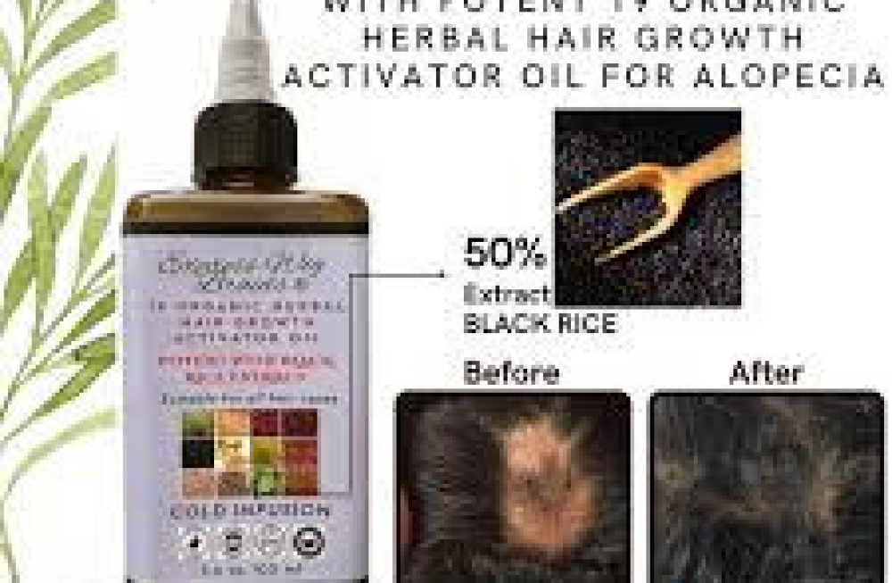 nourish-your-hair-with-rosemary-oil-and-braided-wigs-big-0