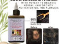 nourish-your-hair-with-rosemary-oil-and-braided-wigs-small-0