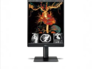 Lg Color Diagnostic Display: Enhance Your Medical Imaging