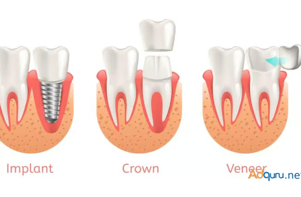 same-day-crowns-in-las-vegas-at-functional-aesthetic-dentistry-big-0