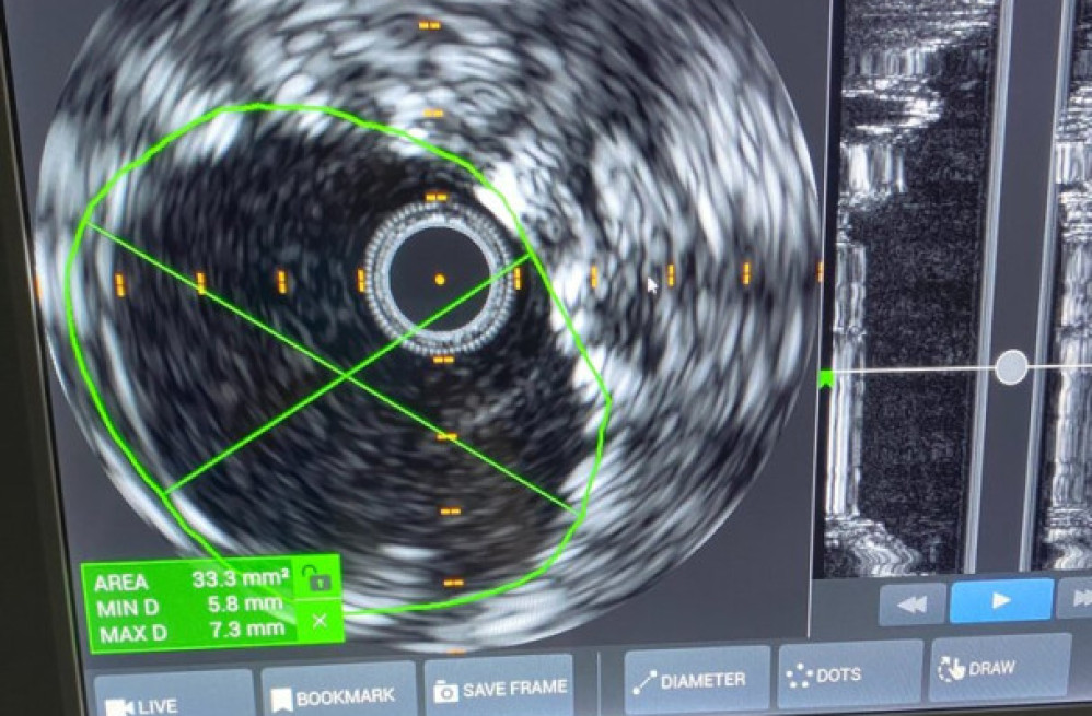 symmetry-vascular-center-big-4