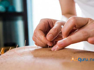 Best fertility acupuncture nyc