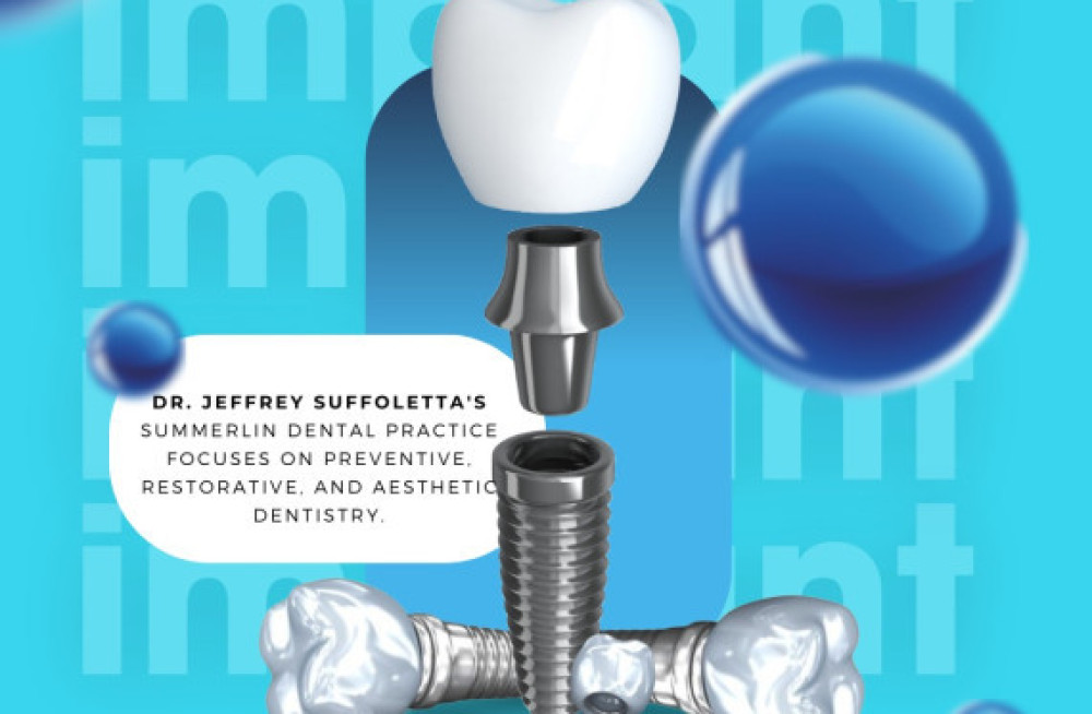 dental-implants-summerlin-big-0