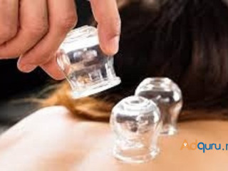 Cupping NYC