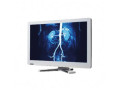 surgical-display-monitors-in-irvine-cutting-edge-visuals-for-surgery-small-0