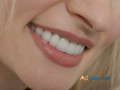 comprehensive-dental-care-at-pleasant-dental-in-bedford-small-0