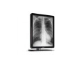 barco-medical-displays-superior-solutions-for-clinical-applications-small-0