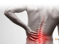 achieve-lasting-pain-relief-with-expert-physical-therapy-at-marcel-jacobs-pt-small-0