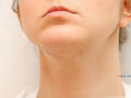 treatments-for-excessive-facial-hair-eflora-cream-small-0