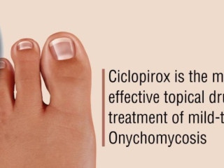 Ciclopirox Nail Lacquer - For Fungal Skin Infections
