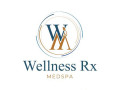 hyperdiluted-radiesse-face-by-wellness-rx-medspa-small-0